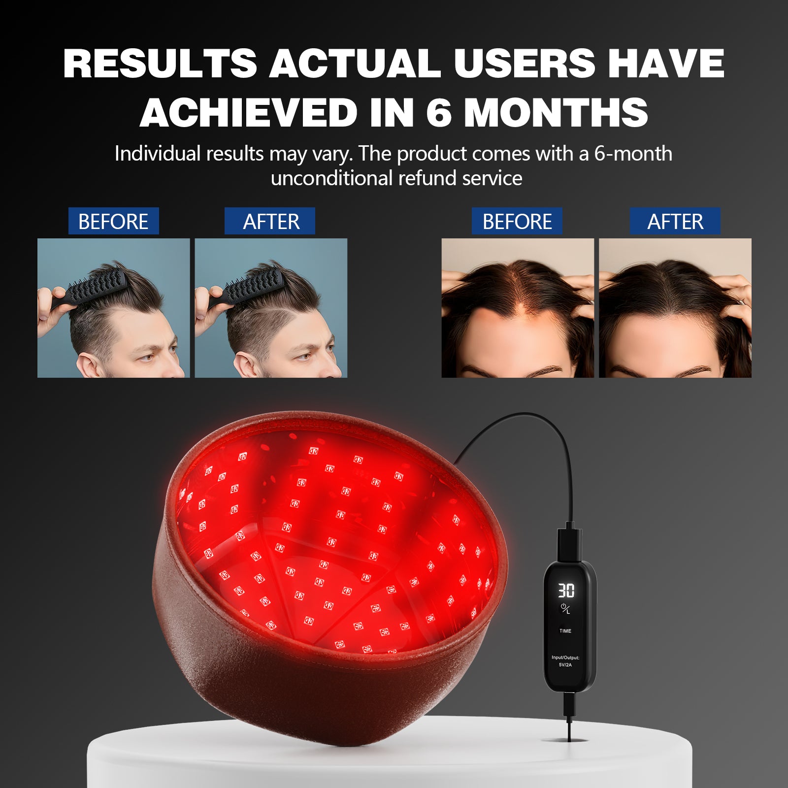 KTS® Laser Hair Regrowth Cap 1.0 Pro